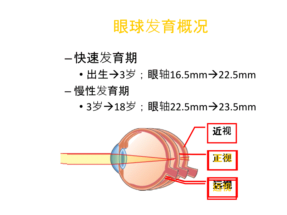 儿童屈光的特点与屈光不正的处理课件_1_第3页