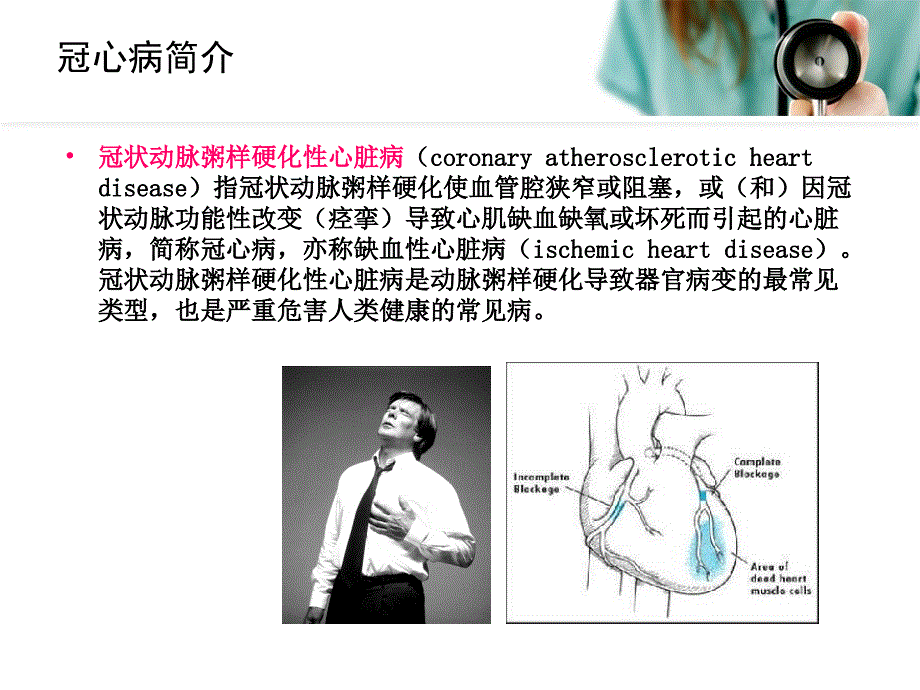 冠心病预防课件_第3页