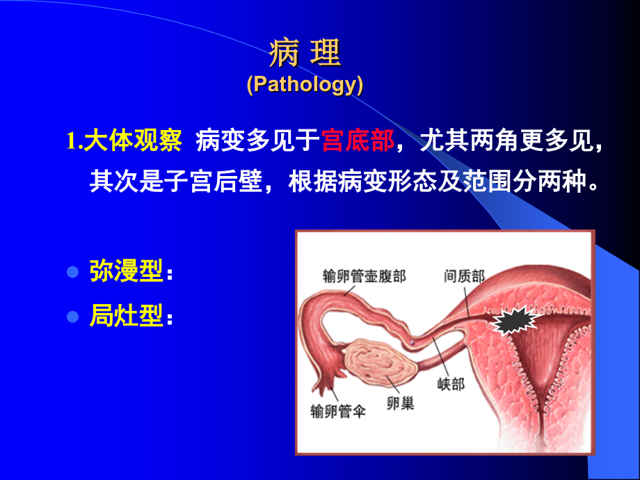 子宫内膜癌及卵巢肿瘤课件_第4页