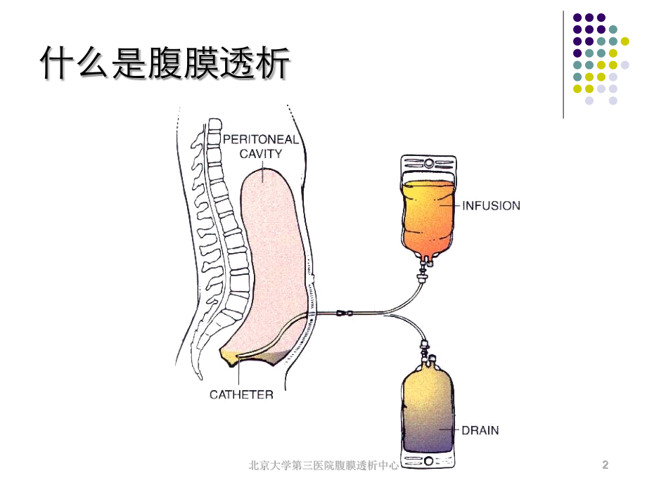 医学腹膜透析 第二版课件_第2页