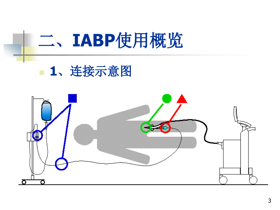 iabp使用培训课件_第3页