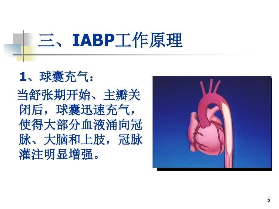 iabp使用培训课件_第5页