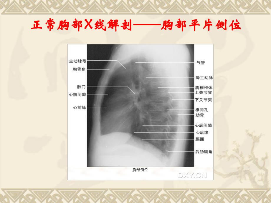 正常头颅x线解剖头颅平片后前位课件_第4页