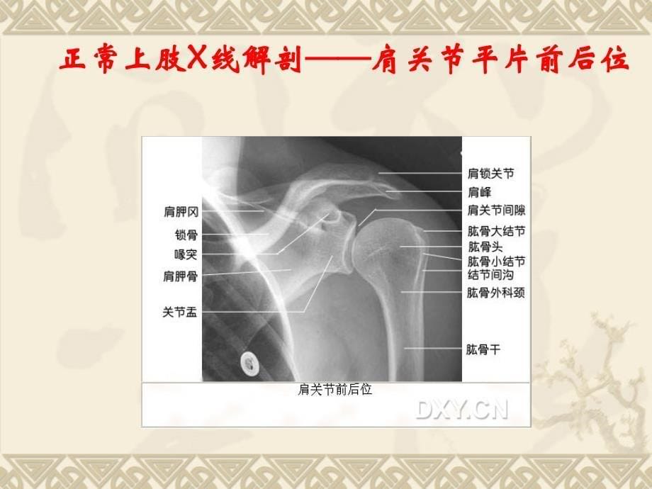 正常头颅x线解剖头颅平片后前位课件_第5页