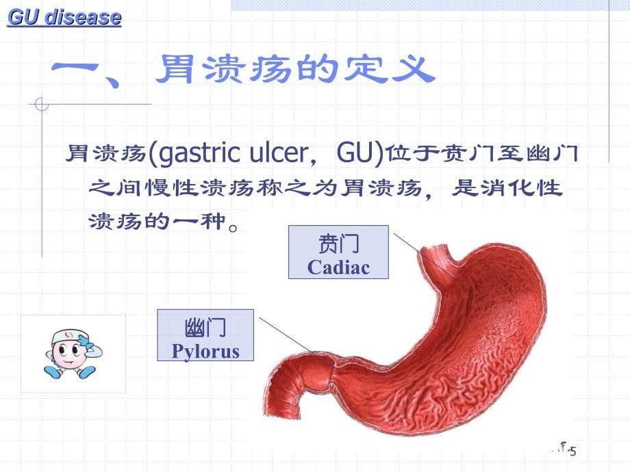 胃溃疡演示文稿课件_第5页