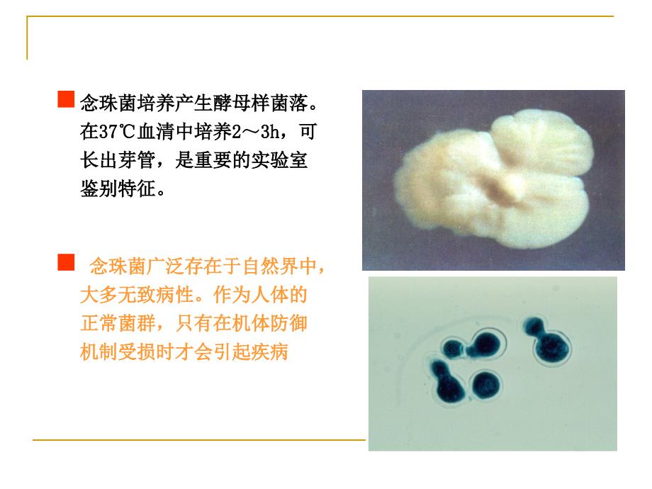 深部真菌感染及治疗药物课件_第4页