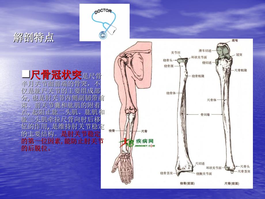 尺骨冠状突骨折护理查房PPT课件_第3页