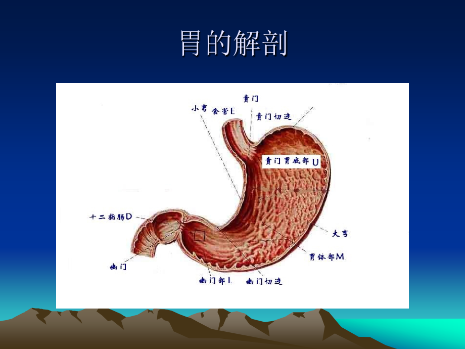 胃十二指肠溃疡外科课件_第3页