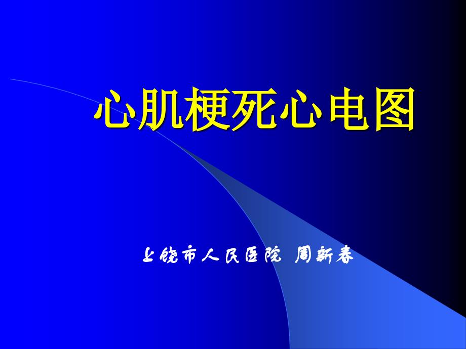 心肌梗死心电图基层胸痛中心培训 ppt课件_第1页