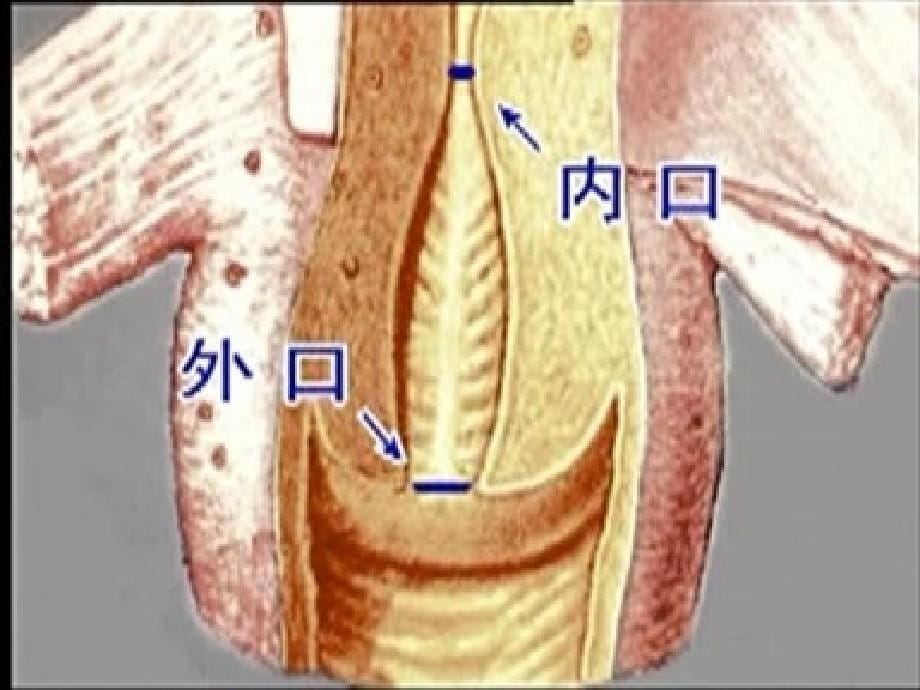 宫颈癌的防治和护理的课件_第5页