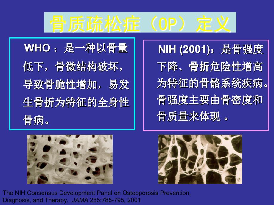 2011年原发性骨质疏松症诊治指南解读课件_第3页