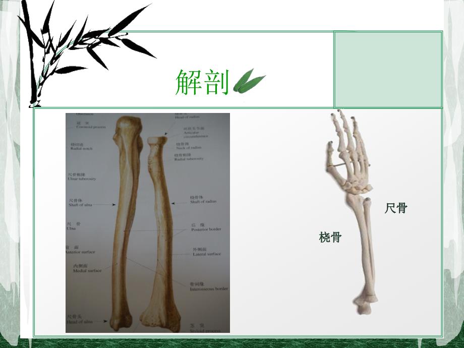 尺桡骨骨折课件（ppt演示）_第3页