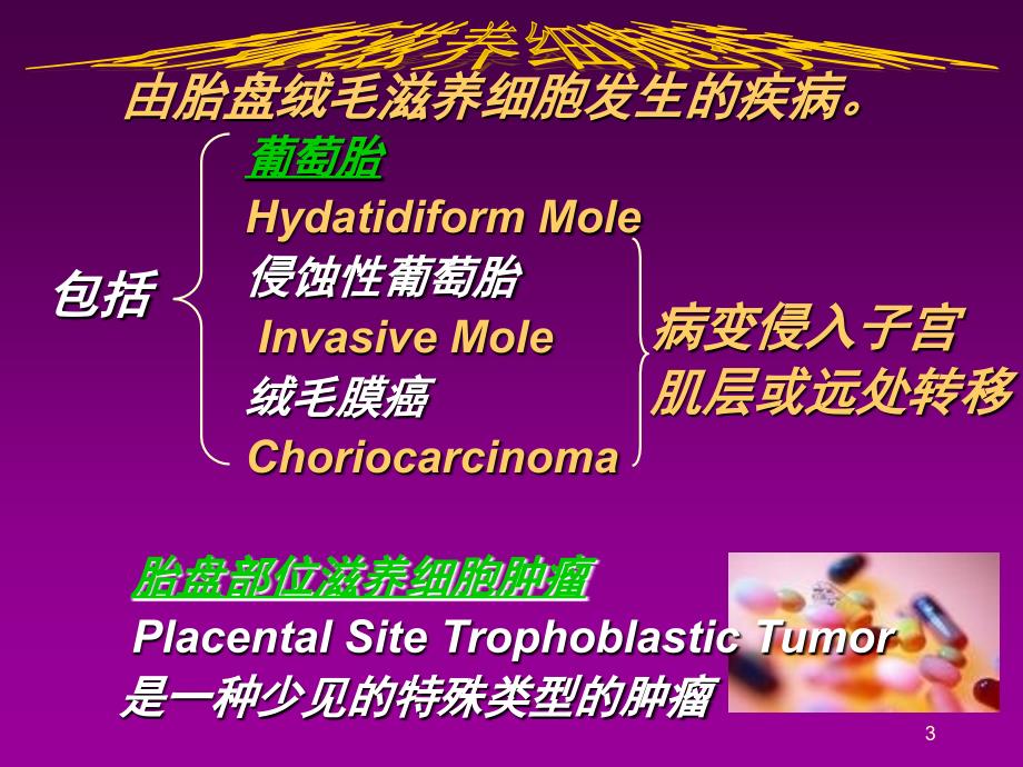 妊娠滋养细胞肿瘤 修改版课件_第3页