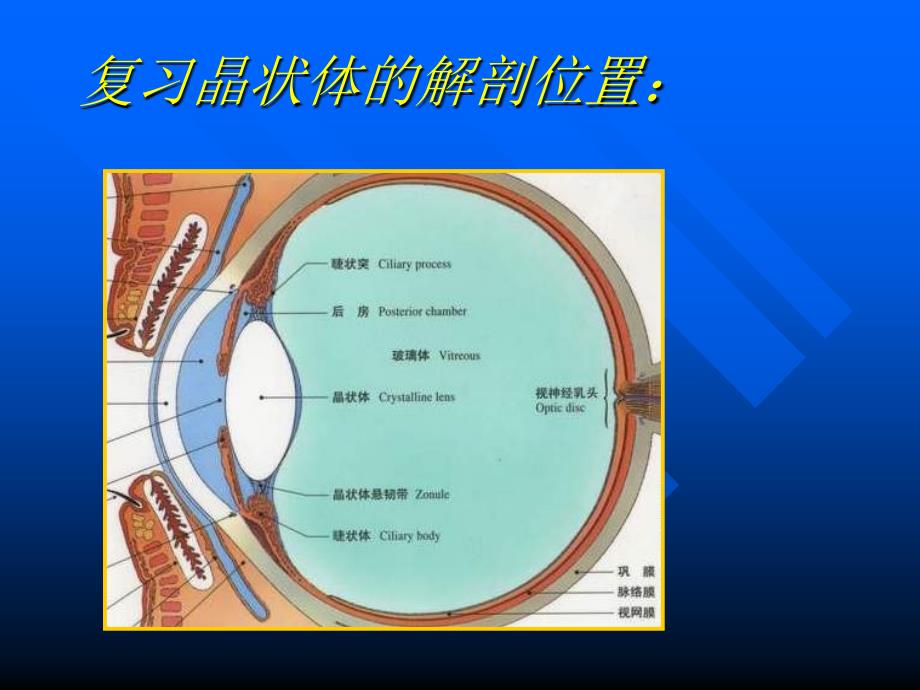 青光眼白内障课件_第4页