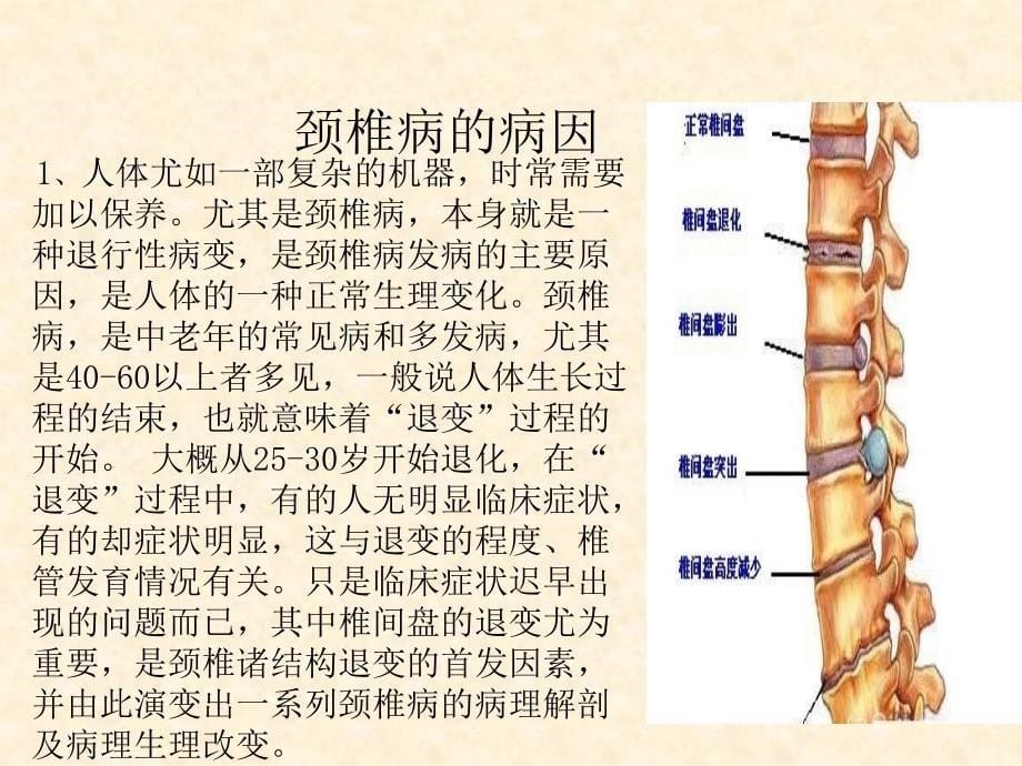 颈椎病预防的培训课件ppt课件_第5页