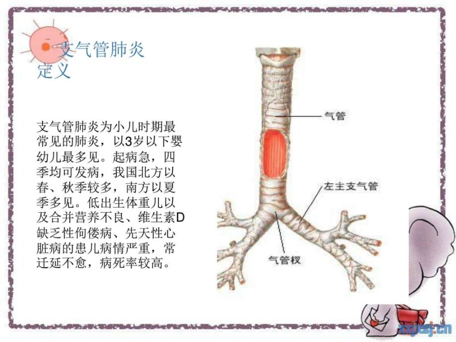 护理查房小儿支气管肺炎整理版图文课件_第2页