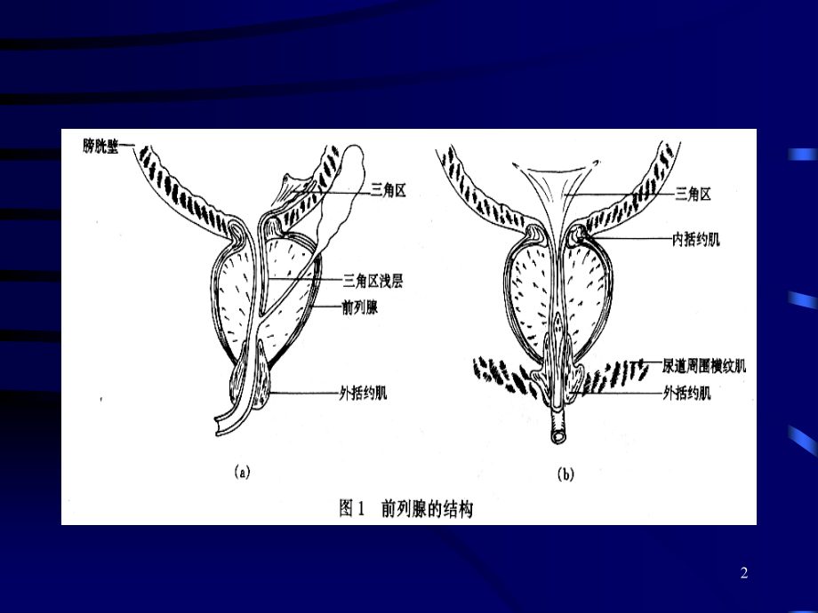 前列腺增生症的临床表现诊断和治疗课件_1_第2页