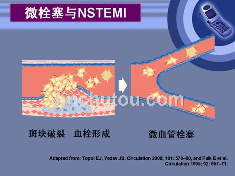 急性冠状动脉综合征抗凝和抗血小板治疗课件_第5页