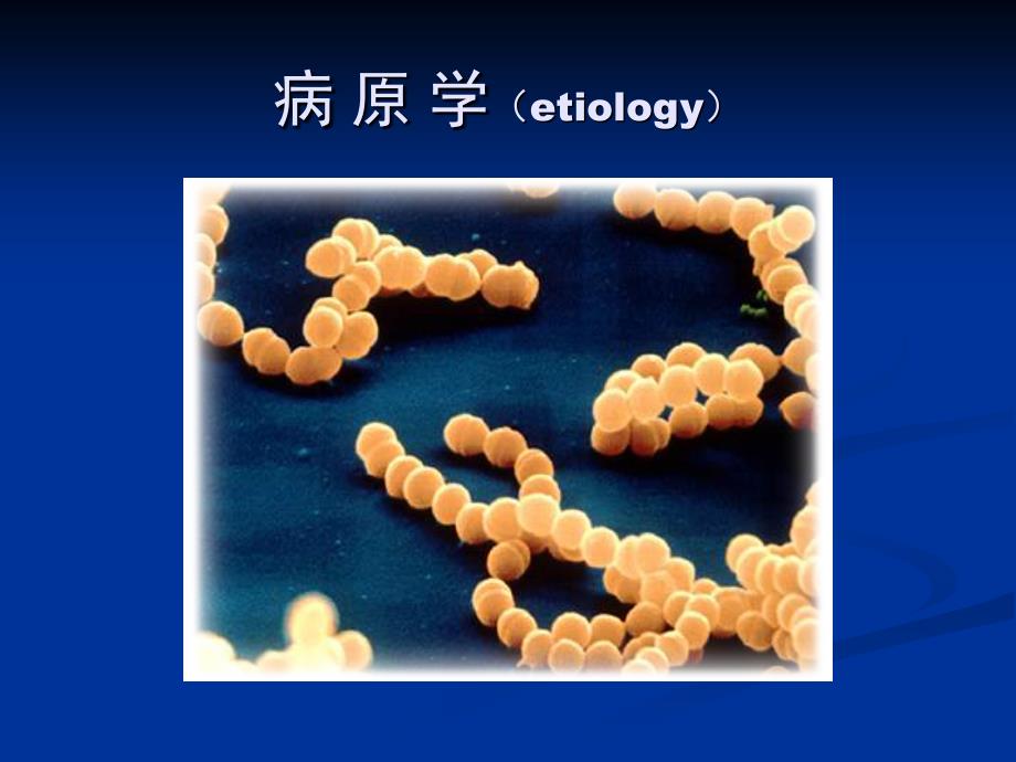 儿传精品教学课件（重庆医科大学）2猩红热_第2页