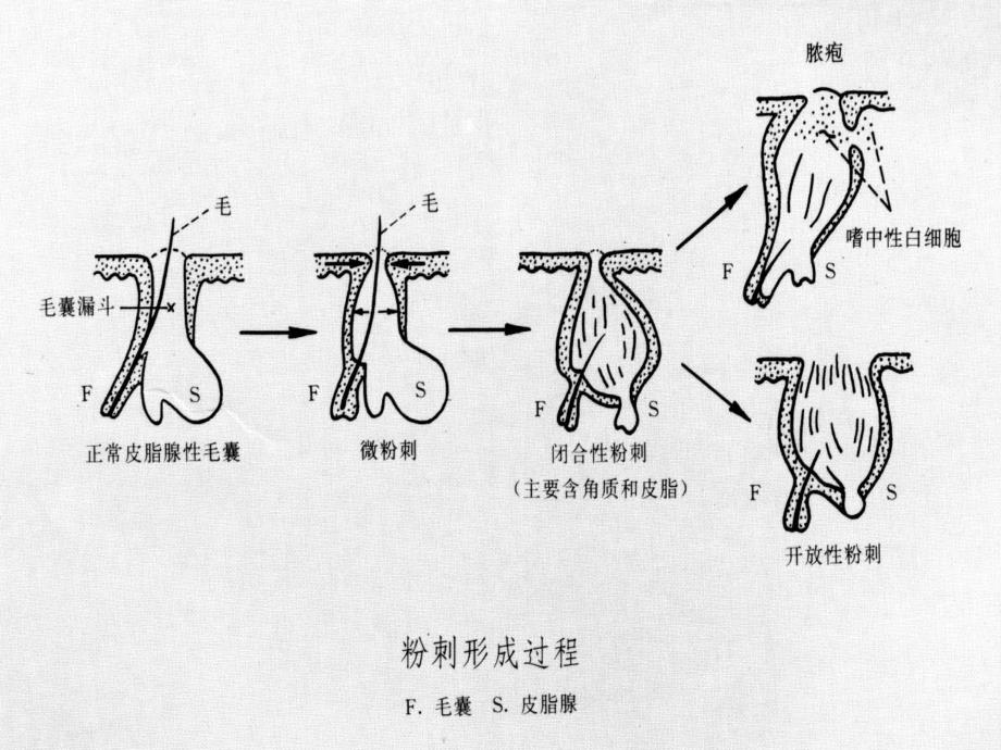 皮肤附属器与色素性疾病课件_第2页