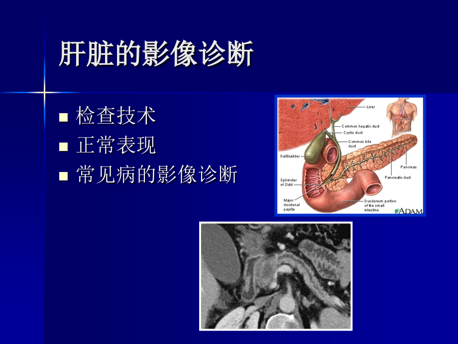 肝胆胰脾影像诊断学课件_3_第2页