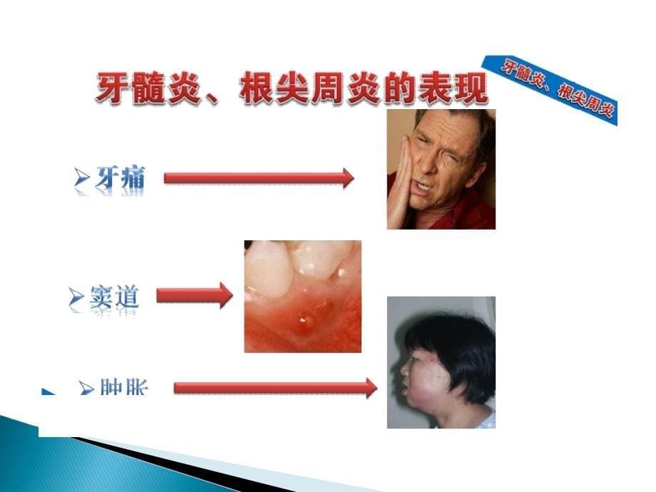 常见的口腔问题课件_第5页