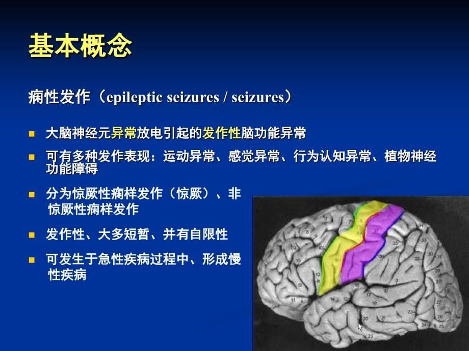 小儿惊厥课件_8_第5页