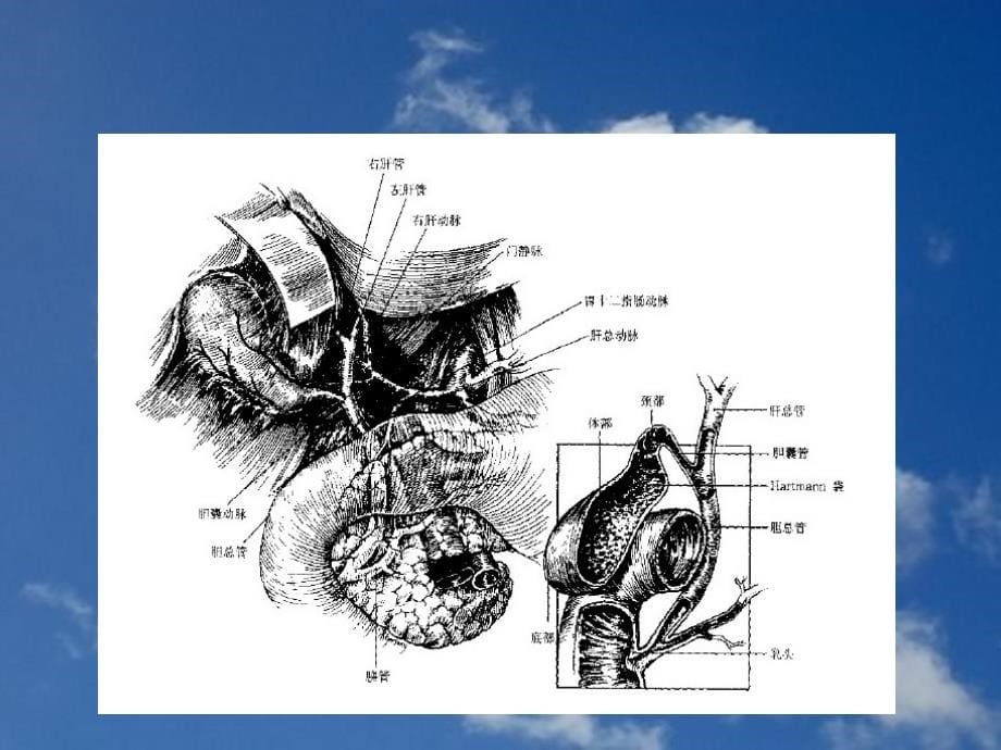 病理学胆道疾病课件_第5页