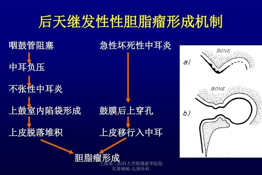 慢性化脓性中耳炎课件_15_第5页