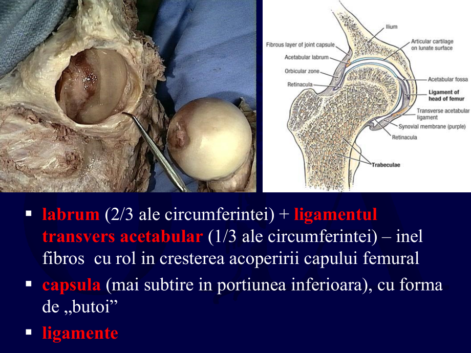 dislocations and femoral head fractures髋关节脱位股骨头骨折课件_第4页