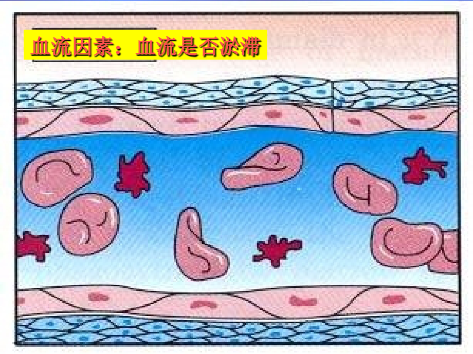 精品血小板与血栓性疾病课件_第3页