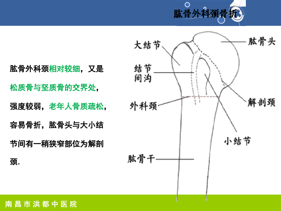 肱骨外科颈骨折护理课件_第4页