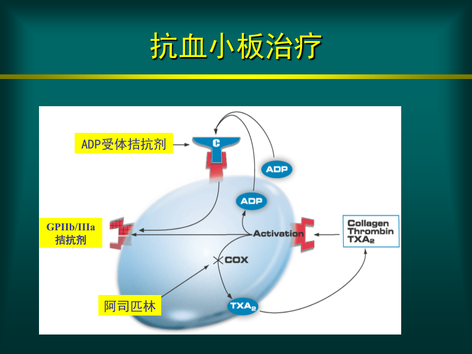 （课件）冠心病抗栓治疗专家共识_第4页