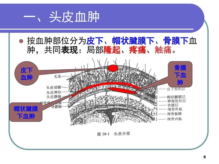 颅脑损伤病人的护理课件 (2)_第5页