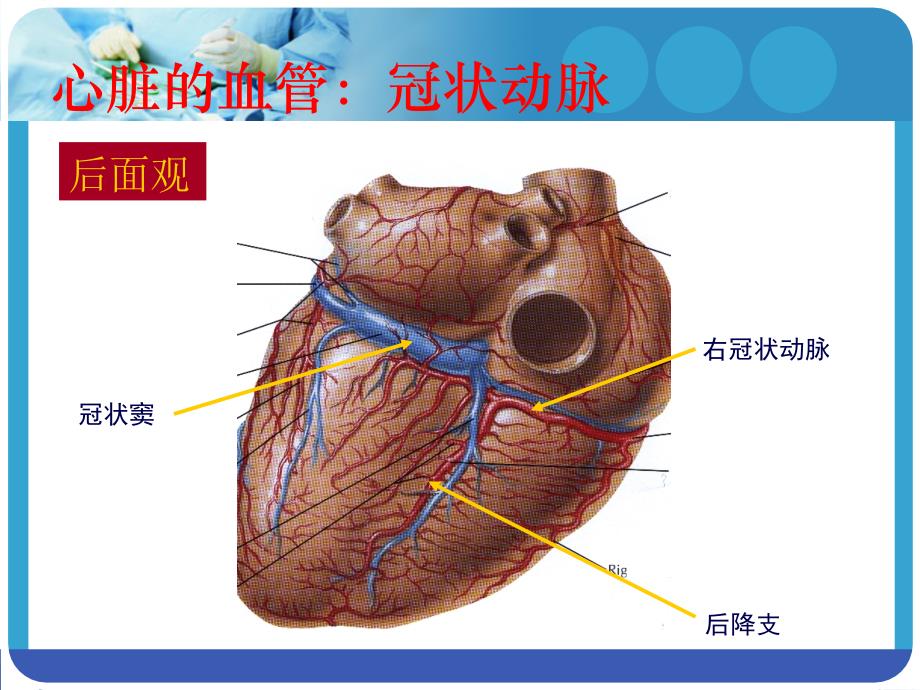 冠状动脉造影术及其护理课件_1_第4页