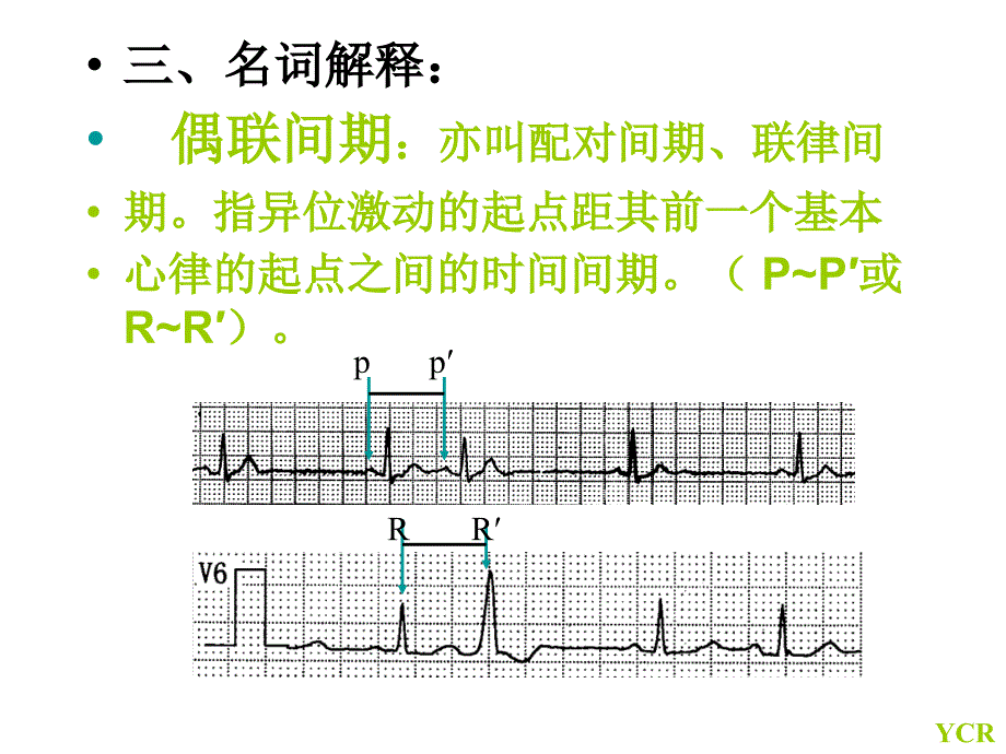 八过早搏动课件_第4页