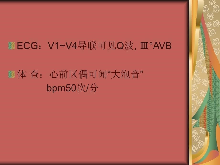 并发房室传导阻滞的护理查房课件_第5页