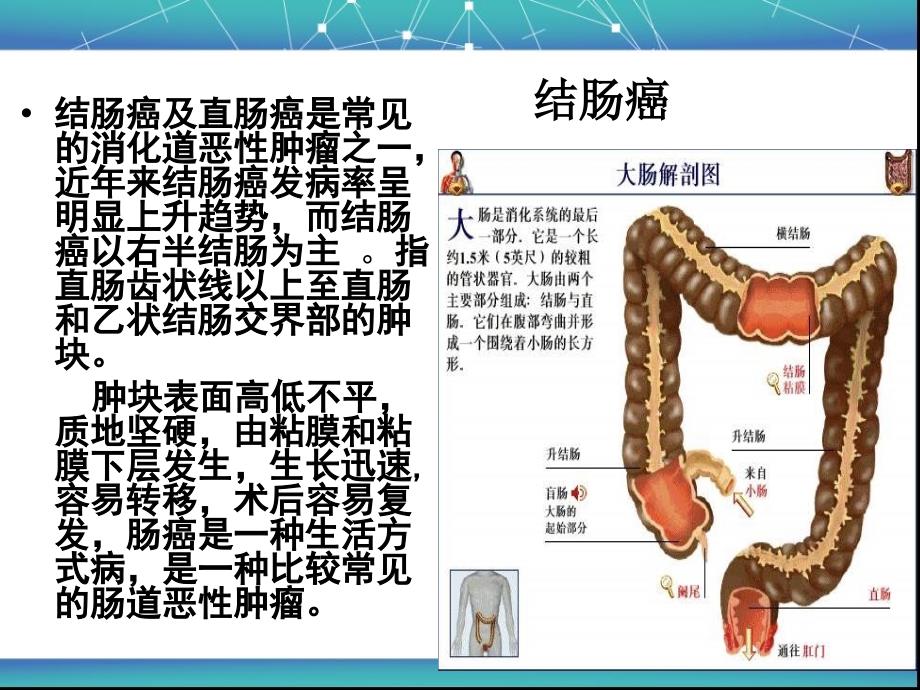 基础医学结肠癌教学课件_第2页