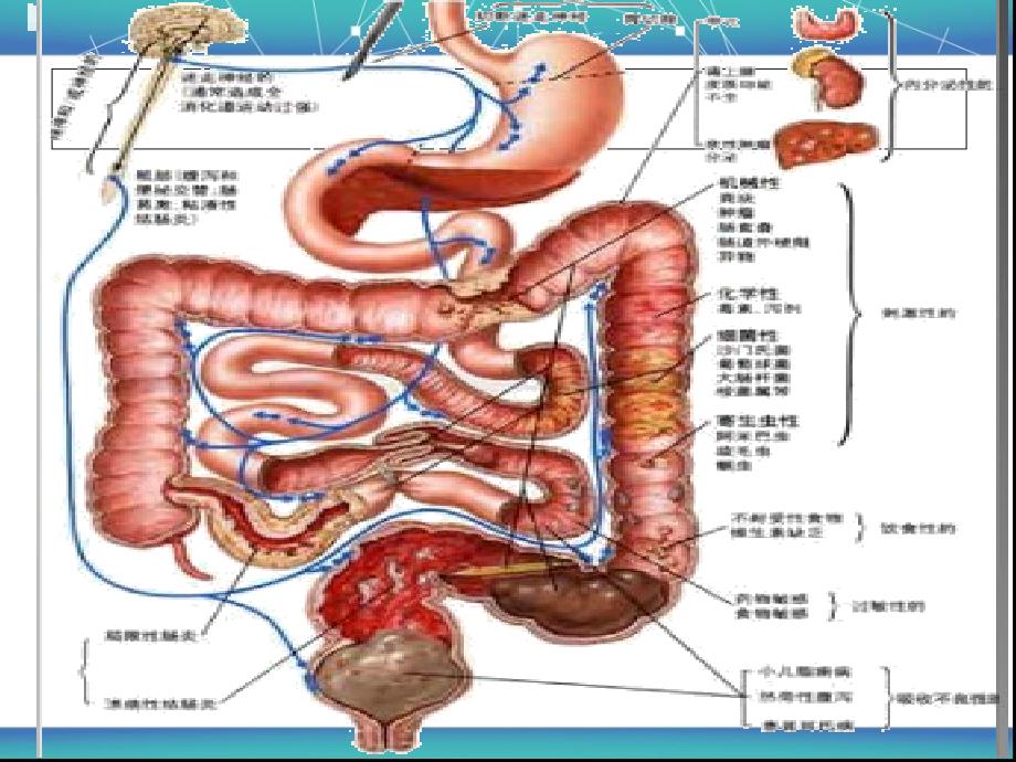 基础医学结肠癌教学课件_第3页