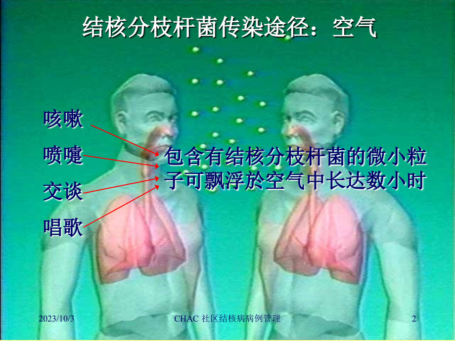 社区结核病病例管理ppt课件_第2页