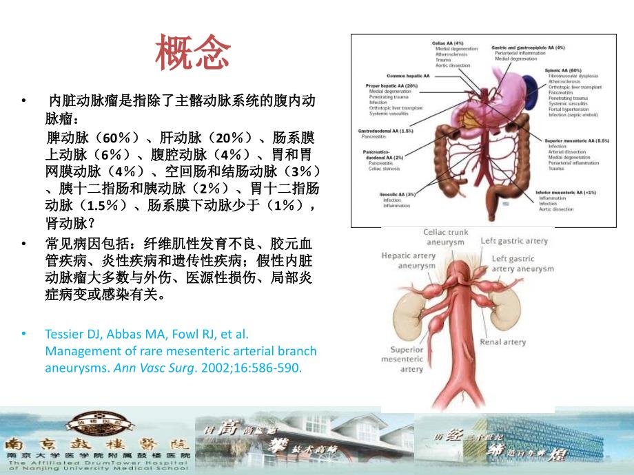 内脏动脉瘤的治疗课件_第2页