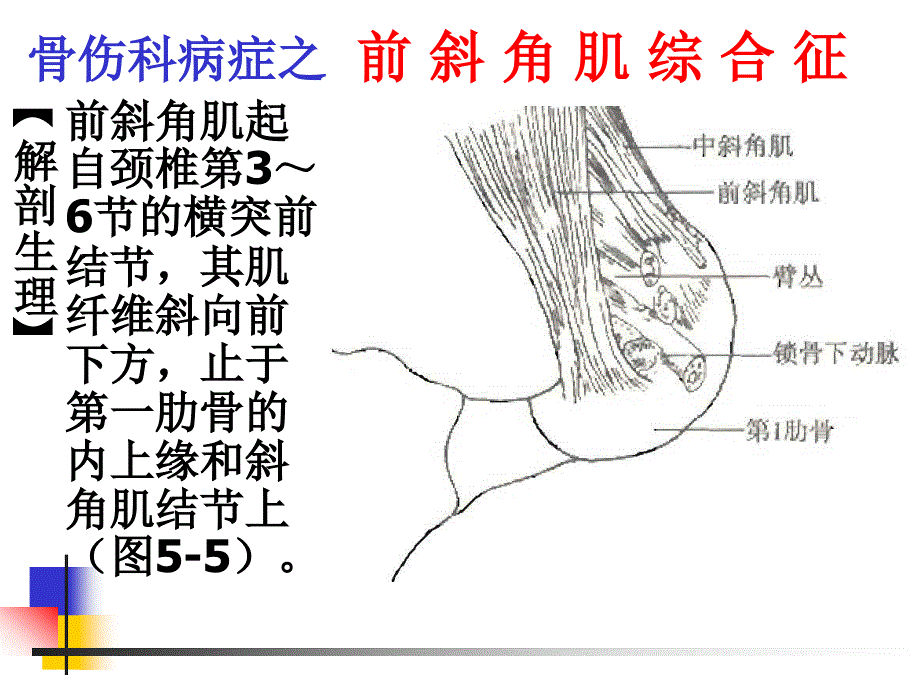 医学503前斜角肌综合征课件_第2页