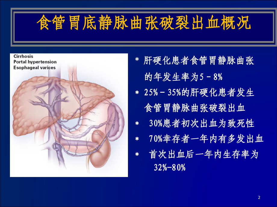 浅析食管胃底静脉曲张破裂出血的各种预防措施课件_第2页