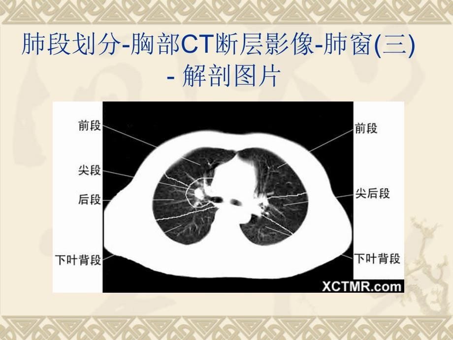 胸上腹和盆腔ct详细实用图解27896ppt课件_第5页