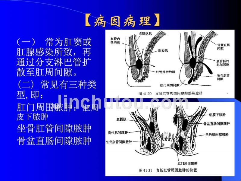 直肠肛管疾病 （课件）_第4页