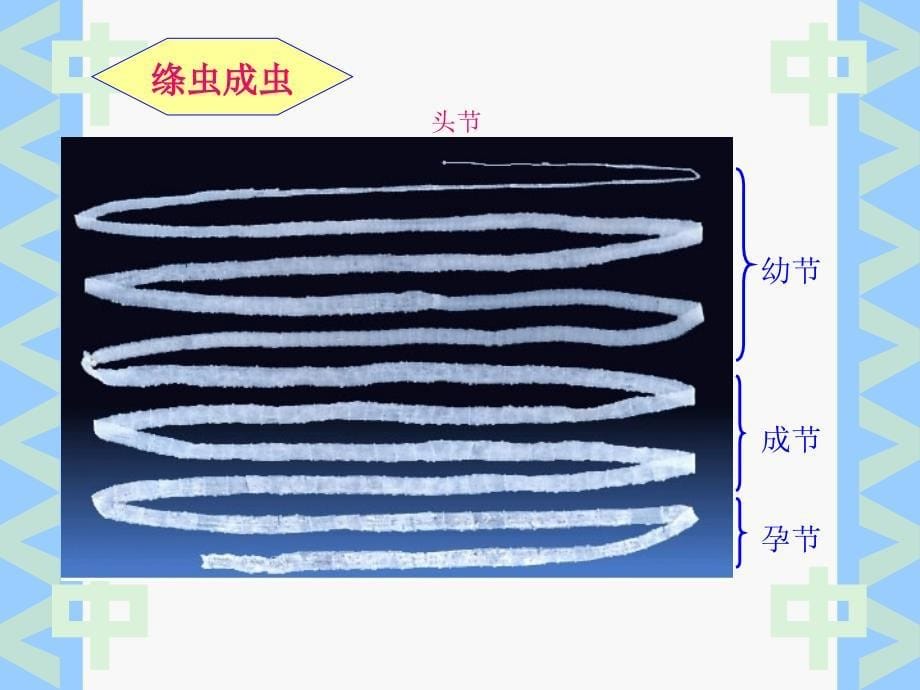 牛带绦虫病课件_第5页