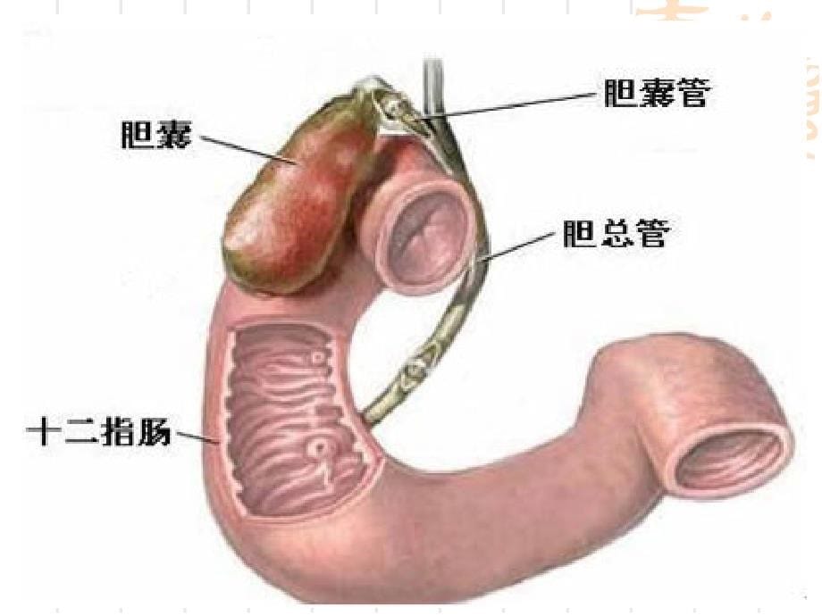 胃十二指肠溃疡、胃癌病人的护理(课件)_第5页