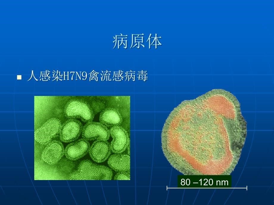 禽流感诊治指南2 ppt课件_第5页