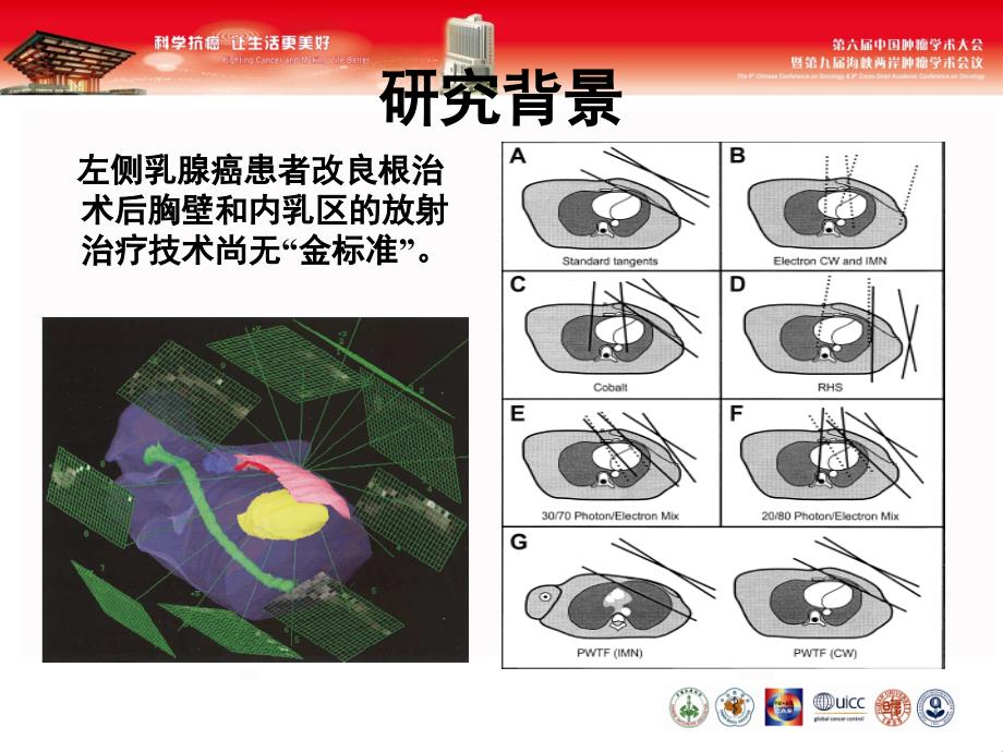 左侧乳腺癌改良根治术后胸壁和内乳区三维课件_第3页