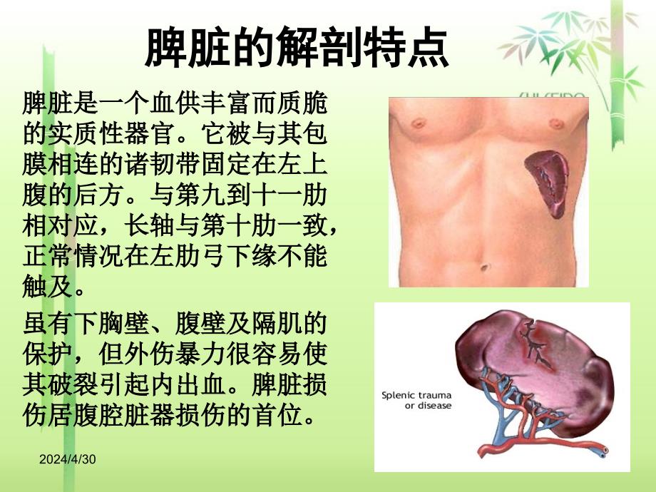 外伤性脾破裂的护理课件_2_第2页